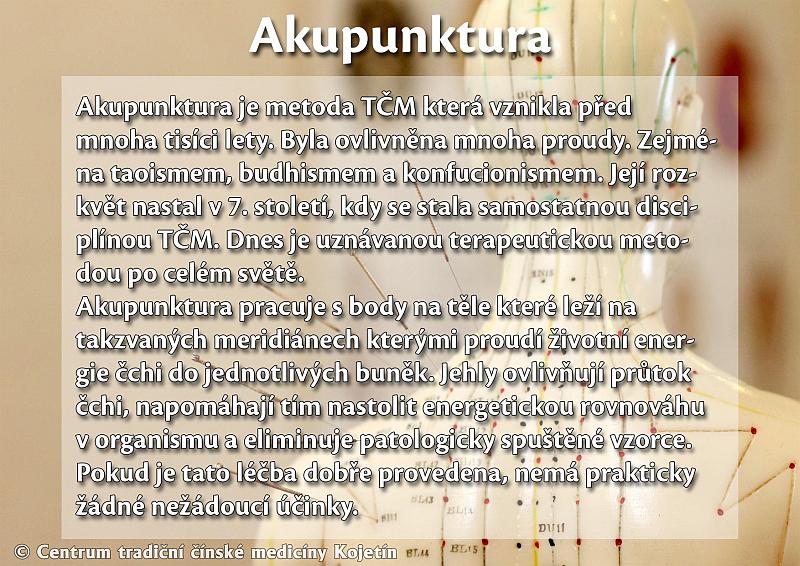 Právě si prohlížíte AKUPUNKTURA
