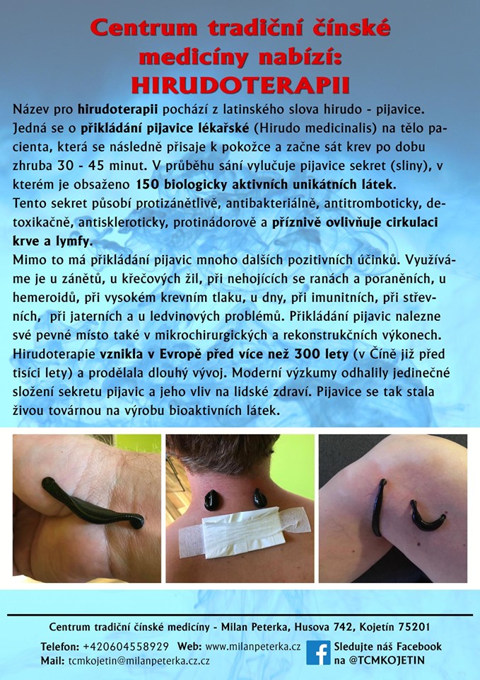 Právě si prohlížíte HIRUDOTERAPIE