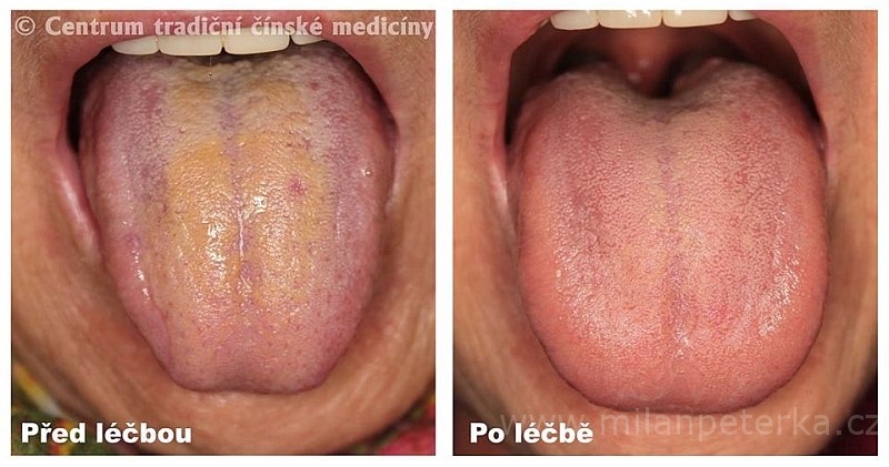Právě si prohlížíte LÉČBA BOLESTI KLOUBŮ