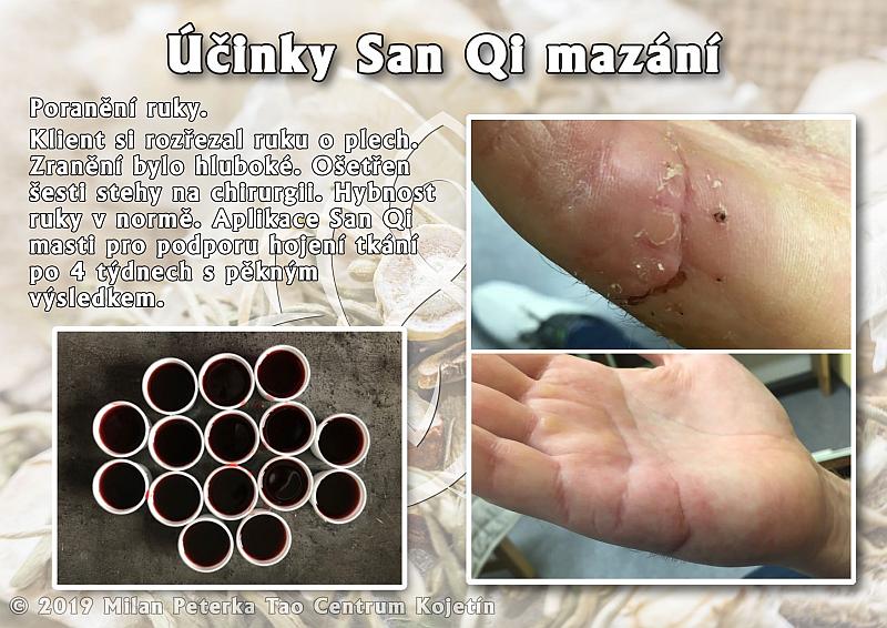 Právě si prohlížíte ÚČINKA SAN-QI MAZÁNÍ